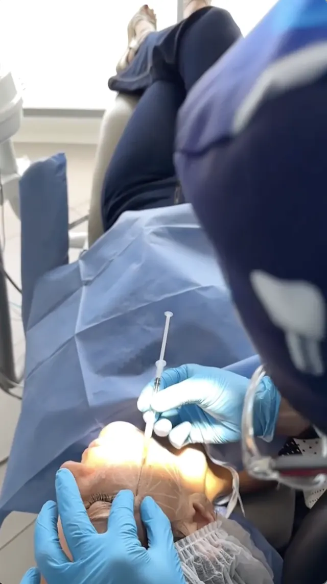 Procedimiento de adipoestructura facial en el consultorio
